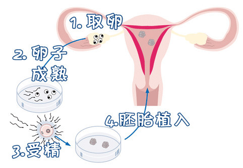 生殖医学科